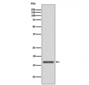 Western blot testing of human MCF7 cell lysate with AGR2 antibody. Expected molecular weight: 17-20 kDa.