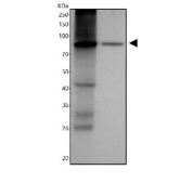 Western blot analysis of Factor XIIIa antibody in human lysates. Human placenta (lane 1) and ThP-1 cell lysate (lane 2) were analyzed using Factor XIIIa antibody rabbit monoclonal clone ACGC-6. The predicted molecular weight of Factor XIII A chain is approximately 83 kDa. A distinct band is observed near the predicted molecular weight in both placenta and ThP-1 lysates, consistent with Factor XIII A chain expression. Placenta shows stronger signal intensity, consistent with known expression in placental macrophage-lineage cells, while ThP-1 cells demonstrate a clear band corresponding to macrophage-associated expression.
