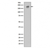 EGFR Antibody WB. Western blot testing of human HeLa cell lysate with EGFR antibody. Expected molecular weight: 134-170 kDa depending on glycosylation level.