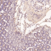 EGFR Antibody Mouse Intestine IHC. Immunohistochemistry staining of FFPE mouse intestine tissue with EGFR antibody. HIER: boil tissue sections in pH6, 10mM citrate buffer, for 10-20 min and allow to cool before testing.