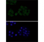 EGFR Antibody HeLa IF. Immunofluorescent staining of FFPE human HeLa cells with EGFR antibody at 1:50 dilution (green) and DAPI nuclear stain (blue). HIER: steam section in pH6 citrate buffer for 20 min.