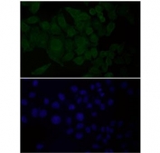 EGFR Antibody FFPE HeLa Cell IF. Immunofluorescent staining of FFPE human HeLa cells with EGFR antibody at 1:150 dilution (green) and DAPI nuclear stain (blue). HIER: steam section in pH6 citrate buffer for 20 min.