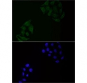 EGFR Antibody Human HeLa Cell IF. Immunofluorescent staining of FFPE human HeLa cells with EGFR antibody at 1:1500 dilution (green) and DAPI nuclear stain (blue). HIER: steam section in pH6 citrate buffer for 20 min.