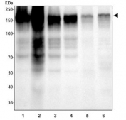 EGFR Antibody Multi-Sample WB. Western blot analysis of human and rodent lysates using EGFR antibody detecting Epidermal growth factor receptor. Lane 1: HeLa, Lane 2: A431, Lane 3: A549, Lane 4: U-87 MG, Lane 5: rat liver, Lane 6: mouse liver. A prominent band is observed at approximately 140-170 kDa, consistent with the predicted molecular weight of EGFR and its known glycosylation. Signal intensity is highest in A431 cells, reflecting elevated EGFR expression. Additional lower molecular weight bands and background signal are present, which may represent degradation products or non-specific binding.