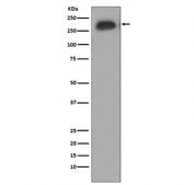 Phospho-EGFR Antibody HUVEC WB. Western blot testing of lysate from HUVEC cells treated with EGF, with phospho-EGFR antibody. Expected molecular weight: 134-170 kDa depending on glycosylation level.