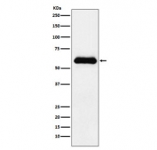 SERPINA3 Antibody Plasma WB. Western blot analysis of Alpha-1-antichymotrypsin / SERPINA3 in human plasma lysate using recombinant rabbit monoclonal SERPINA3 antibody, clone ADED-19. A prominent band is observed at approximately 50â65 kDa, consistent with the predicted molecular weight of SERPINA3 and its known glycosylated forms, while the lower end of this range may represent less modified protein species. This migration pattern reflects variable glycosylation of this secreted plasma protein, a feature commonly reported for Alpha-1-antichymotrypsin in western blot analysis.