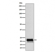 FSH beta Antibody Pituitary WB. Western blot testing of human pituitary lysate with FSH beta antibody. Expected molecular weight: 17-23 kDa depending on level of glycosylation.