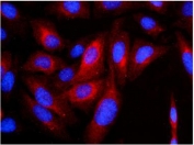Keratin 8 Antibody U-2 OS Cell IF. Immunofluorescent staining of FFPE U-2 OS cells using Keratin 8 Antibody demonstrates distinct red cytoplasmic staining consistent with expression of Cytokeratin 8 (CK8/KRT8), a type II intermediate filament protein involved in epithelial cytoskeletal organization and cellular structural integrity. The staining pattern highlights the filamentous cytoplasmic distribution characteristic of intermediate filament proteins, while DAPI (blue) counterstains cell nuclei. This image demonstrates intracellular localization of CK8 and supports the utility of the antibody for immunofluorescence applications. HIER: steam tissue sections in pH 6 citrate buffer for 20 minutes prior to staining.