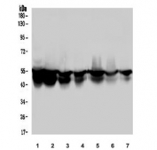 Keratin 8 Antibody Multi-Cell Line Western Blot. Western blot analysis of placenta (lane 1), Caco-2 (lane 2), A549 (lane 3), A431 (lane 4), HeLa (lane 5), K562 (lane 6), and HEK293 (lane 7) lysates using Keratin 8 Antibody demonstrates a prominent band at approximately 56 kDa, consistent with the expected molecular weight of Cytokeratin 8 (CK8/KRT8). Cytokeratin 8 is a type II intermediate filament protein widely expressed in simple epithelial tissues and many epithelial-derived cell lines, where it contributes to cytoskeletal organization, cellular integrity, and stress-response signaling. Detection of the expected molecular weight band across multiple lysates supports expression of CK8 and the suitability of this antibody for western blot applications.