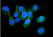 L-Plastin Antibody Human U-2 OS IF. Immunofluorescent staining of FFPE human U-2 OS cells with L-Plastin antibody revealed predominantly cytoplasmic staining with punctate and peripheral localization consistent with the distribution of L-plastin (LCP1), a calcium-regulated actin-bundling protein involved in cytoskeletal remodeling and cell migration. L-plastin is best known as a leukocyte marker but is also expressed in several malignancies, where it contributes to invasive and metastatic behavior. Green fluorescence indicates L-Plastin expression, while nuclei are counterstained with DAPI (blue). Heat-induced epitope retrieval was performed by steaming sections in pH 6 citrate buffer for 20 minutes prior to immunostaining.