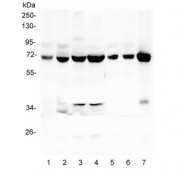 L-Plastin Antibody Human and Rodent Immune Cell WB. Western blot analysis of LCP1 expression was performed using anti-L-Plastin antibody in lysates from human CCRF-CEM, HEK293, HL-60, and THP-1 cells, rat spleen, mouse spleen, and mouse RAW264 cells. L-plastin, also known as Lymphocyte Cytosolic Protein 1 (LCP1), is a calcium-regulated actin-bundling protein predominantly expressed in hematopoietic cells and involved in leukocyte migration, immune cell activation, and cytoskeletal remodeling. Lane 1: CCRF-CEM. Lane 2: HEK293. Lane 3: HL-60. Lane 4: THP-1. Lane 5: rat spleen. Lane 6: mouse spleen. Lane 7: mouse RAW264 lysate. A prominent immunoreactive band is detected at approximately 70 kDa in all samples, corresponding to the predicted molecular weight of L-plastin. Strong expression in immune cell lines and lymphoid tissues is consistent with the established role of L-plastin as a marker of hematopoietic cells and mediator of leukocyte function. These results support the utility of L-Plastin Antibody for studies of innate immunity, inflammation, hematopoiesis, and cell migration.