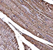 IHC staining of FFPE human skeletal muscle tissue with DOK7 antibody. HIER: boil tissue sections in pH8 EDTA for 20 min and allow to cool before testing.