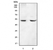 Western blot testing of human 1) MCF7 and 2) RT4 cell lysate with DOK7 antibody. Predicted molecular weight ~53 kDa.