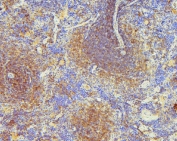 IHC staining of FFPE rat spleen with ARPC1B antibody. HIER: boil tissue sections in pH6, 10mM citrate buffer, for 20 min and allow to cool before testing.