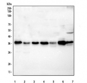 Western blot testing of 1) human PC-3, 2) human U937, 3) human HeLa, 4) rat spleen, 5) rat thymus, 6) mouse spleen and 7) mouse thymus tissue lysate with ARPC1B antibody. Predicted molecular weight ~41 kDa.