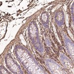 IGHG1 Antibody Human Colon IHC. Immunohistochemistry was performed on paraffin-embedded human colon tissue using IGHG1 Antibody at a 1:100 dilution. Scattered cytoplasmic staining is observed in plasma cells within the colonic lamina propria, while the epithelial cells of the colonic crypts remain largely unstained. This staining pattern is consistent with the expected localization of human IgG1-producing plasma cells in normal colonic mucosa. These results demonstrate that this Human IgG Antibody is suitable for immunohistochemical detection of IGHG1 in formalin-fixed, paraffin-embedded human tissues.
