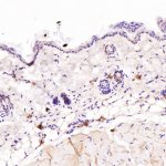 IGHG1 Antibody Mouse Skin IHC. Immunohistochemistry was performed on paraffin-embedded mouse skin tissue using IGHG1 Antibody at a 1:100 dilution. Scattered cytoplasmic staining is observed in immune cells within the dermis, while the epidermis and surrounding skin structures exhibit minimal background staining. This staining pattern is consistent with the expected localization of IgG1-positive immune cells in normal skin. These results demonstrate that this Human IgG Antibody is suitable for immunohistochemical detection of IGHG1 in formalin-fixed, paraffin-embedded tissues.