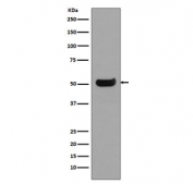 Western blot testing of human spleen lysate with Human IgG4/IGHG4 antibody. Predicted molecular weight ~50 kDa.