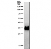 HLA-DRA Antibody for WB testing of rat spleen tissue lysate by western blot. A band is detected at approximately 34 kDa, consistent with the predicted molecular weight of Human leukocyte antigen DR alpha / HLA-DRA, the HLA-DR alpha chain of the MHC class II antigen presentation complex expressed in immune cells present in spleen tissue.