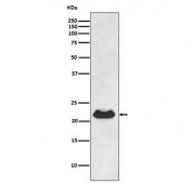 Alpha B Crystallin Antibody Fetal Heart WB. Western blot testing of human fetal heart lysate with Alpha B Crystallin antibody. Predicted molecular weight ~20 kDa.