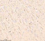 Myelin Basic Protein Antibody in Pig Brain IHC. Immunohistochemistry staining of FFPE pig brain tissue with Myelin Basic Protein Antibody / MBP [clone IIE-13]. HIER was performed in EDTA buffer, pH 8.0, followed by blocking with 10% goat serum. The antibody was used at 1:50 overnight at 4oC, followed by a peroxidase-conjugated goat anti-rabbit IgG secondary antibody and DAB detection. This Myelin Basic Protein Antibody demonstrates MBP localization in pig brain tissue.