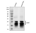 Myelin Basic Protein Antibody in Rat and Mouse Brain WB. Western blot testing of rat and mouse brain tissue lysates with Myelin Basic Protein Antibody / MBP [clone IIE-13]. Lane 1: rat brain; Lane 2: mouse brain. Samples were separated by 12% SDS-PAGE under reducing conditions and the antibody was used at 1:500 overnight at 4oC. A goat anti-rabbit IgG-HRP secondary antibody was used at 1:5000. Specific bands corresponding to MBP isoforms were detected at approximately 16-22 kDa in both samples. This Myelin Basic Protein Antibody demonstrates detection of MBP in rat and mouse brain tissue.