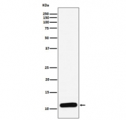 PF4 Antibody Human Spleen WB. Western blot testing of human spleen tissue lysate with PF4 Antibody. A specific band was detected at approximately 10 kDa, consistent with the expected migration range of Platelet Factor 4. PF4 has a predicted monomeric molecular weight of approximately 8 kDa but may also be detected as higher molecular weight dimeric or tetrameric forms due to its natural oligomerization properties. PF4 Antibody / Platelet Activation Marker Antibody supports analysis of platelet-derived chemokine expression, alpha granule biology and platelet activation signaling pathways.