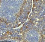 PF4 Antibody Mouse Spleen IHC. Immunohistochemistry staining of FFPE mouse spleen tissue with PF4 Antibody at 1:50 dilution. HIER was performed using pH 8 EDTA buffer, followed by blocking with 10% goat serum. The tissue section was incubated with rabbit anti-PF4 antibody overnight at 4Â°C, followed by HRP-conjugated goat anti-rabbit IgG secondary antibody and DAB chromogen detection. PF4 Antibody / Platelet Activation Marker Antibody demonstrates staining consistent with platelet-derived chemokine expression and supports studies of platelet activation, alpha granule biology and immune regulation pathways.