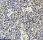 PF4 Antibody Rat Spleen IHC. Immunohistochemistry staining of FFPE rat spleen tissue with PF4 Antibody at 1:50 dilution. HIER was performed using pH 8 EDTA buffer, followed by blocking with 10% goat serum. The tissue section was incubated with rabbit anti-PF4 antibody overnight at 4Â°C, followed by HRP-conjugated goat anti-rabbit IgG secondary antibody and DAB chromogen detection. PF4 Antibody / Platelet Activation Marker Antibody demonstrates staining consistent with Platelet Factor 4 expression in platelet-rich regions and supports studies of platelet activation, alpha granule biology and immune signaling pathways.