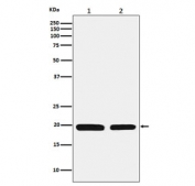 Ferritin Light Chain Antibody HepG2 and Mouse Liver WB. Western blot analysis of 1) human HepG2 and 2) mouse liver lysates using Ferritin Light Chain Antibody detects strong bands at approximately 20 kDa in both samples, consistent with ferritin light chain / FTL. The observed cross-species banding profile supports detection of this intracellular ferritin subunit involved in ferritin complex assembly, iron sequestration, and oxidative stress-responsive cellular regulation pathways in metabolically active hepatic tissues.