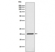Ferritin Antibody WB. Western blot testing of human Jurkat antibody with Ferritin antibody. Predicted molecular weight ~21 kDa.