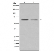 ER alpha Antibody Breast Cancer Cell Line WB. Western blot testing of human 1) MCF7 and 2) T-47D cell lysate with ER alpha antibody. Predicted molecular weight ~66 kDa.