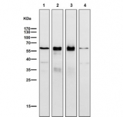 ER alpha Antibody Mouse Rat WB. Western blot testing of 1) mouse testis, 2) mouse uterus, 3) mouse ovary and 4) rat testis tissue lysate with ER alpha antibody. Predicted molecular weight ~66 kDa.