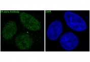 ER alpha Antibody MCF7 IF. Immunofluorescent staining of FFPE human MCF7 cells with ER alpha antibody (green) and DAPI nuclear stain (blue). HIER: steam section in pH6 citrate buffer for 20 min.