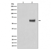 Phospho-ER alpha (pS118) Antibody MCF7 WB. Western blot analysis of human MCF7 cell lysates (lane 1: untreated, lane 2: beta-estradiol and EGF treated) using phospho-ER alpha (pS118) antibody detects a band at approximately 65-70 kDa, consistent with the predicted molecular weight of Estrogen receptor alpha (ESR1), with increased signal in treated cells reflecting hormone- and growth factor-induced phosphorylation; clone EIG-5 was used for detection.