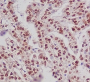 Phospho-ER alpha (pS118) Antibody Kidney Tissue IHC. Immunohistochemistry of FFPE human kidney tissue using phospho-ER alpha (pS118) antibody shows HRP-DAB brown nuclear staining in epithelial cells, consistent with phosphorylation at serine 118 and activation of ESR1 signaling, while surrounding stromal elements display lower background; detection was performed with clone EIG-5. HIER: boil tissue sections in pH6 citrate buffer for 20 min and allow to cool before testing.