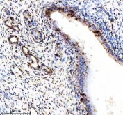 Phospho-ER alpha (pS118) Antibody Rat Uterus IHC. Immunohistochemistry of FFPE rat uterus tissue using phospho-ER alpha (pS118) antibody demonstrates HRP-DAB brown nuclear staining in uterine epithelial and stromal cells, consistent with estrogen-responsive phosphorylation at serine 118 and active ESR1 signaling in reproductive tissue, while background staining remains minimal; detection was performed with clone EIG-5. HIER: boil tissue sections in pH8 EDTA for 20 min and allow to cool before testing.