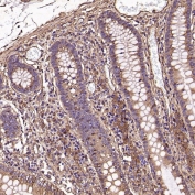 Collagenase 1 Antibody Human Colon IHC. Immunohistochemistry analysis of FFPE human colon tissue using Collagenase 1 Antibody. Heat induced antigen retrieval was performed by boiling tissue sections in pH 6 citrate buffer for 10â20 minutes prior to staining. Positive staining is observed predominantly in stromal and inflammatory cell populations surrounding the colonic crypts, consistent with MMP1 expression associated with extracellular matrix remodeling and tissue homeostasis. These results support the use of Collagenase 1 Antibody for studying MMP1 expression, collagen degradation and extracellular matrix remodeling in normal gastrointestinal tissue.