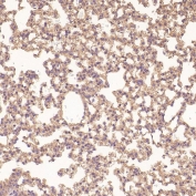 Collagenase 1 Antibody Mouse Lung IHC. Immunohistochemistry analysis of FFPE mouse lung tissue using Collagenase 1 Antibody. Heat induced antigen retrieval was performed by boiling tissue sections in pH 6 citrate buffer for 10â20 minutes prior to staining. Positive staining is observed in pulmonary cells throughout the lung parenchyma, consistent with MMP1 expression associated with extracellular matrix remodeling and normal tissue homeostasis. These results support the use of Collagenase 1 Antibody for studying MMP1 expression, collagen degradation and extracellular matrix remodeling in pulmonary tissues.