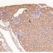 Collagenase 1 Antibody Mouse Kidney IHC. Immunohistochemistry analysis of FFPE mouse kidney tissue using Collagenase 1 Antibody. Heat induced antigen retrieval was performed by boiling tissue sections in pH 6 citrate buffer for 10â20 minutes prior to staining. Predominantly cytoplasmic staining is observed in renal tubular epithelial cells, consistent with MMP1 expression associated with extracellular matrix remodeling and tissue homeostasis. These results support the use of Collagenase 1 Antibody for studying MMP1 expression, collagen degradation and extracellular matrix remodeling in renal tissues.