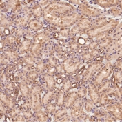 Collagenase 1 Antibody Rat Kidney IHC. Immunohistochemistry analysis of FFPE rat kidney tissue using Collagenase 1 Antibody. Heat induced antigen retrieval was performed by boiling tissue sections in pH 6 citrate buffer for 10â20 minutes prior to staining. Predominantly cytoplasmic staining is observed in renal tubular epithelial cells, consistent with MMP1 expression associated with extracellular matrix remodeling and normal tissue homeostasis. These results support the use of Collagenase 1 Antibody for studying MMP1 expression, collagen degradation and extracellular matrix remodeling in renal tissues.