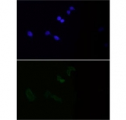 Collagenase 1 Antibody HeLa Cell IF. Immunofluorescence analysis of FFPE human HeLa cells using Collagenase 1 Antibody. Heat induced antigen retrieval was performed by boiling sections in pH 6 citrate buffer for 20 minutes prior to staining. Collagenase 1 expression is shown in green with DAPI nuclear counterstain shown in blue. Predominantly cytoplasmic staining is observed, consistent with intracellular synthesis and processing of the MMP1 proenzyme before secretion. These results support the use of Collagenase 1 Antibody for studying MMP1 expression, collagen degradation and extracellular matrix remodeling.