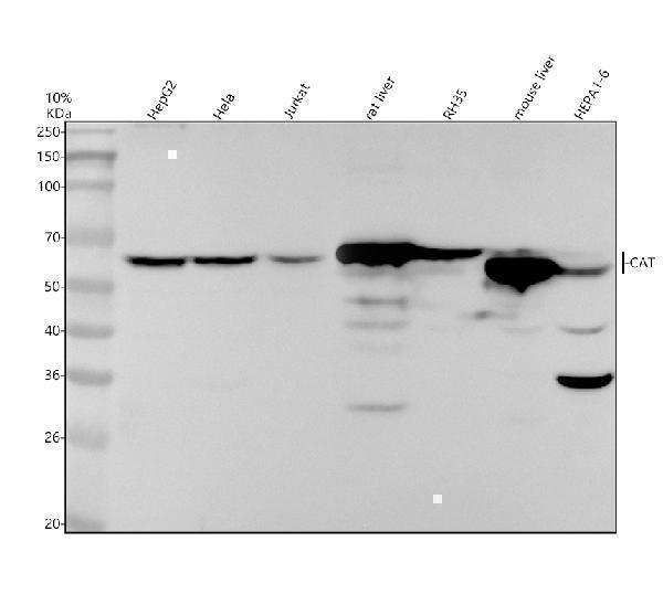 Catalase Antibody / Peroxisomal Antioxidant Enzyme Multi-Species WB. Western blot analysis of 1) human HepG2, 2) human HeLa, 3) human Jurkat, 4) rat liver, 5) rat RH35, 6) mouse liver, and 7) mouse HEPA1-6 lysates using Catalase Antibody / Peroxisomal Antioxidant Enzyme, clone AAGA-3. A prominent immunoreactive band is detected at approximately 60-65 kDa in all samples, consistent with the expected molecular weight of catalase (~60 kDa), supporting specific detection of the endogenous peroxisomal antioxidant enzyme across human, rat, and mouse cell and tissue lysates.