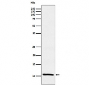 TFF1 Antibody for WB. Western blot analysis of human MCF7 cell lysate using TFF1 Antibody for WB. Lane 1: human MCF7 cell lysate. A band is detected at approximately 12 kDa, consistent with the predicted molecular weight of Trefoil factor 1 (TFF1). The observed band reflects expression of the small secreted trefoil peptide originally identified as the estrogen inducible protein pS2 in breast cancer cells, aligning with the known estrogen-responsive expression of TFF1 in MCF7 breast carcinoma cells.