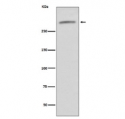 von Willebrand Factor Antibody for WB. Western blot of human serum lysate using von Willebrand Factor Antibody for WB (clone IHF-22) shows a prominent band at approximately 300-320 kDa, consistent with the predicted molecular weight of von Willebrand factor (VWF). The observed high molecular weight signal reflects the heavily glycosylated nature of VWF, which commonly migrates at an elevated apparent size on SDS-PAGE relative to its core polypeptide.