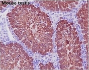 IHC staining of FFPE mouse testis with GAPDH antibody. HIER: boil tissue sections in pH6, 10mM citrate buffer, for 10-20 min and allow to cool before testing.