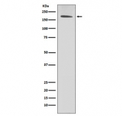 HER2 Antibody SK-BR-3 Cell WB. Western blot testing of human SK-BR-3 cell lysate with HER2 antibody.