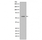Phospho-p53 Antibody T-47D WB. Western blot analysis of human T-47D cell lysate treated with etoposide using phospho-p53 antibody detecting p53 phosphorylated at Ser33, clone ACD-20. A band is detected at approximately 53 kDa, consistent with the predicted molecular weight of p53. Detection in etoposide-treated cells is consistent with activation of p53 in response to DNA damage.