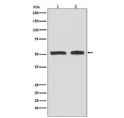 Phospho-TP53 Antibody Multi-Cell WB. Western blot analysis of human HepG2 and HeLa cell lysates treated with etoposide using phospho-TP53 antibody detecting TP53 phosphorylated at Ser9, clone ADO-20. A band is detected at approximately 53 kDa in both samples, consistent with the predicted molecular weight of TP53. Detection is consistent with stress-induced modulation of TP53 signaling.