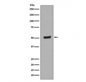 Phospho-p53 Antibody HEK293 WB. Western blot analysis of human HEK293 cell lysates treated with Calyculin A and okadaic acid using phospho-p53 antibody detecting p53 phosphorylated at Thr55, clone DGO-20. A band is detected at approximately 53 kDa, consistent with the predicted molecular weight of p53. Detection under phosphatase inhibition conditions is consistent with accumulation of phosphorylated p53 and regulation of p53 stability and turnover.